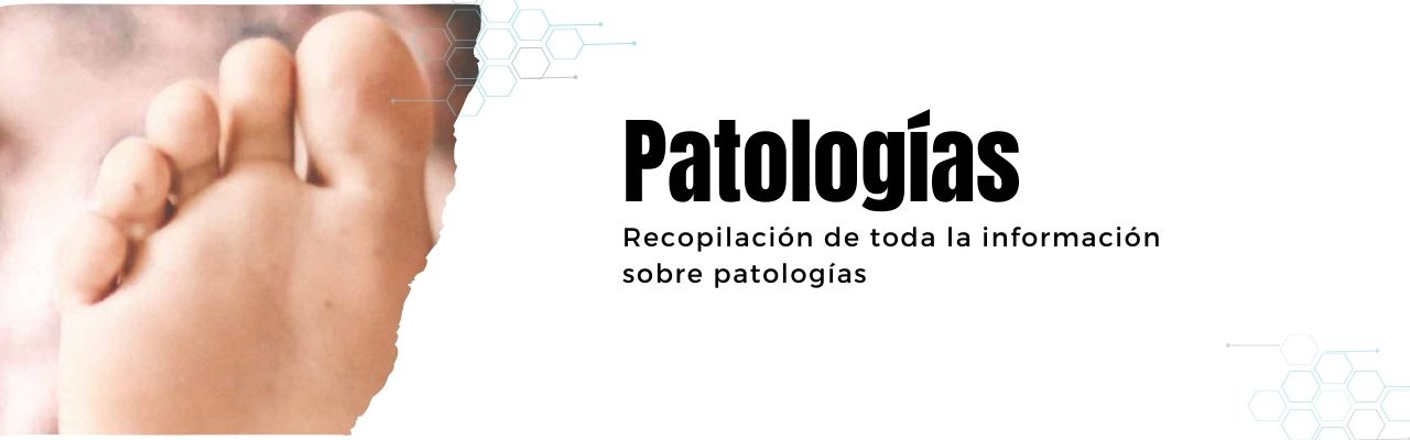 Patologías podológicas | Herbitas